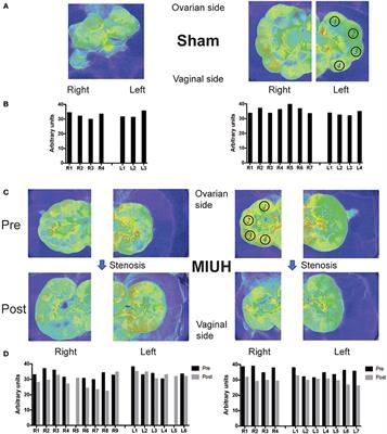 Mild Intrauterine Hypoperfusion Leads to Lumbar and Cortical Hyperexcitability, Spasticity, and Muscle Dysfunctions in Rats: Implications for Prematurity